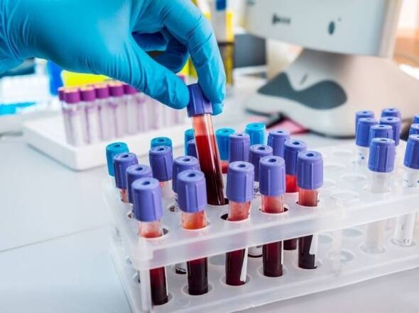 fertility bloodwork