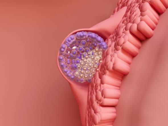 Implantation Failure In A Failed Ivf Cycle Digital Render